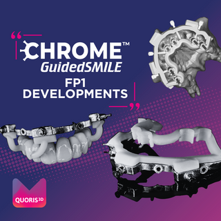 FP1 Developments: Key Enhancements to GuidedSMILE Natural a Potential Game Changer