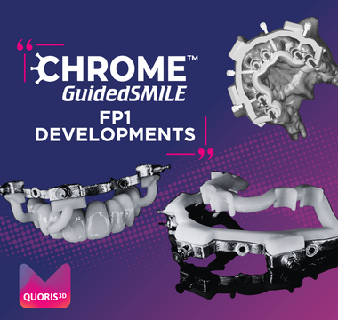 FP1 Developments: Key Enhancements to GuidedSMILE Natural a Potential Game Changer