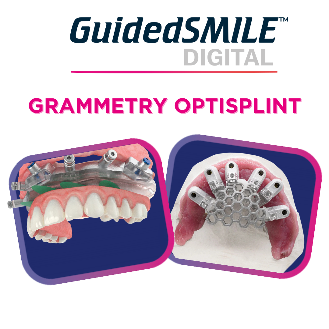 GuidedSMILE Digital Complete Grammetry