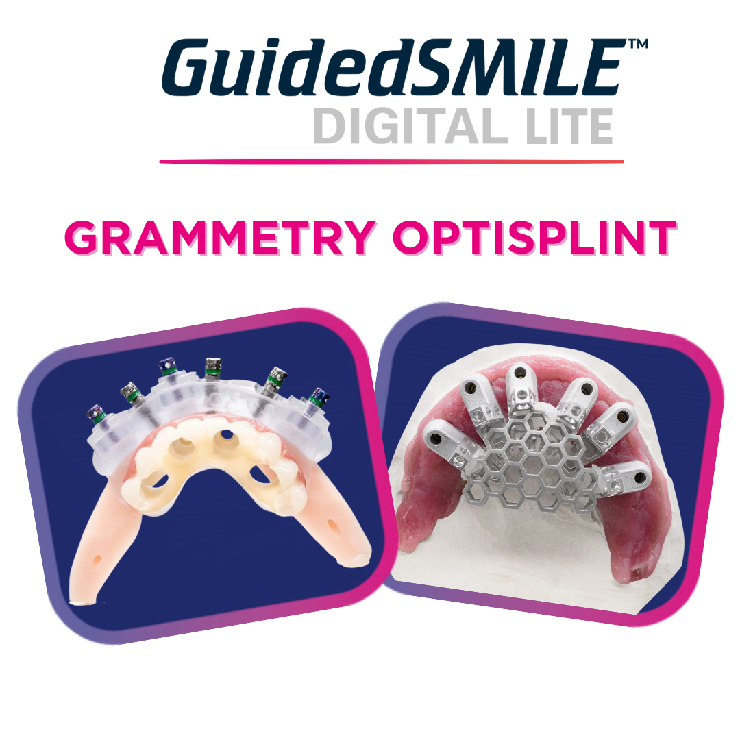 GuidedSMILE Digital Lite Grammetry