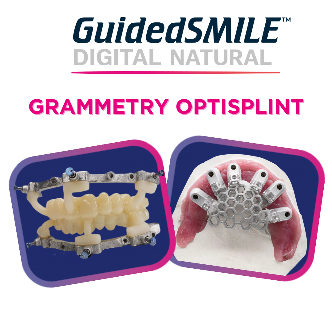 GuidedSMILE Digital Natural Grammetry